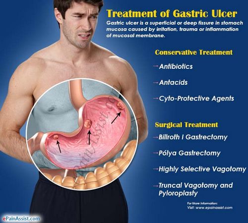 Stomach Ulcer Treatment - Surgery is Often the Only Cure 